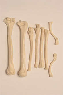 Left and right upper arm, radius, ulna and clavicle