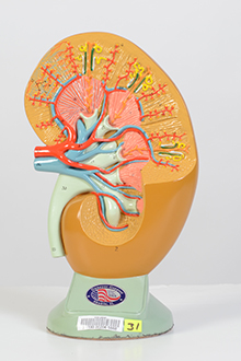  Kidney model