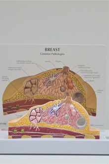 breast common pathologies model