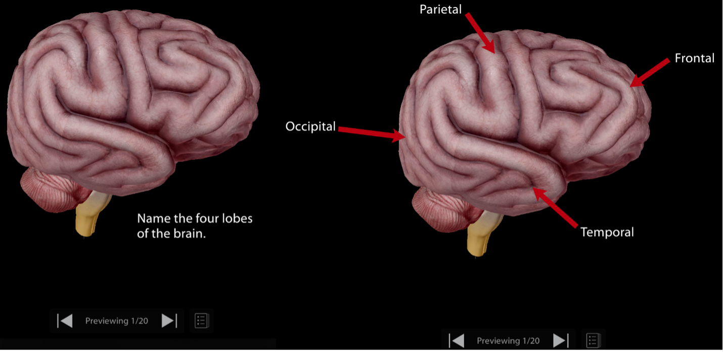 Photo of the brain from VB Suite