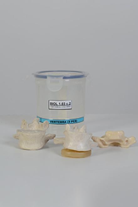 Vertebrae model #2