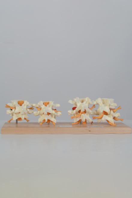 Lumbar spine degeneration model