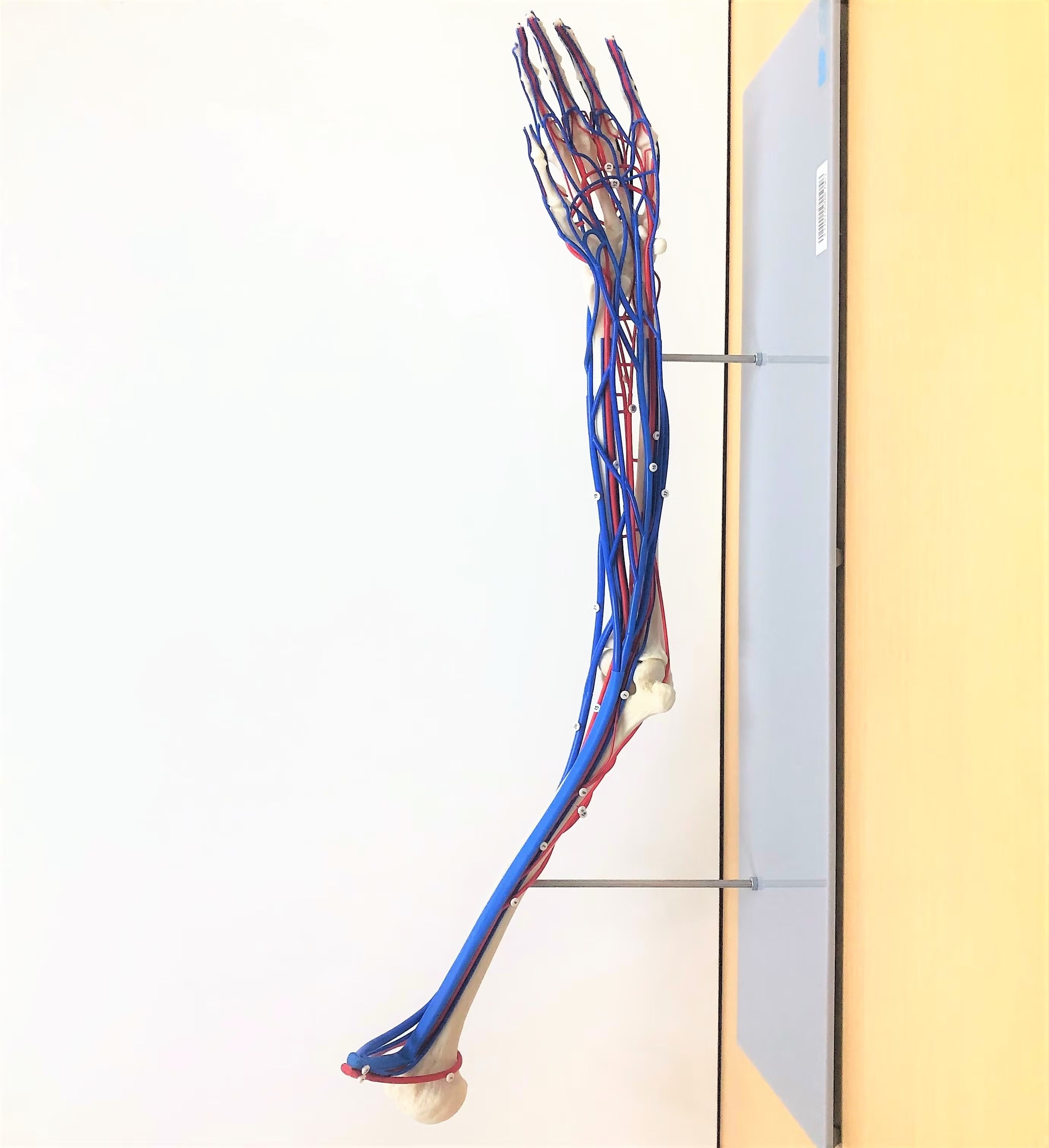 Picture of a vascular arm model